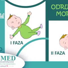 Ilustracja pokazuje dwie fazy odruchu Moro: pierwszą, gdy dziecko wyciąga ręce, i drugą, kiedy zanika odruch.