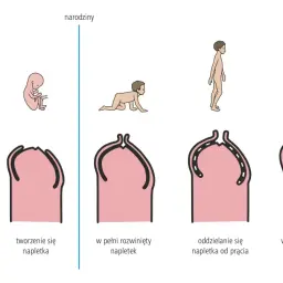 Rozwój prącia i napletka od zawiązka do stanu w pełni odprowadzalnego. Ilustracja pokazuje, jak napletek może być początkowo zrośnięty, co może być przyczyną stulejki u dziecka.