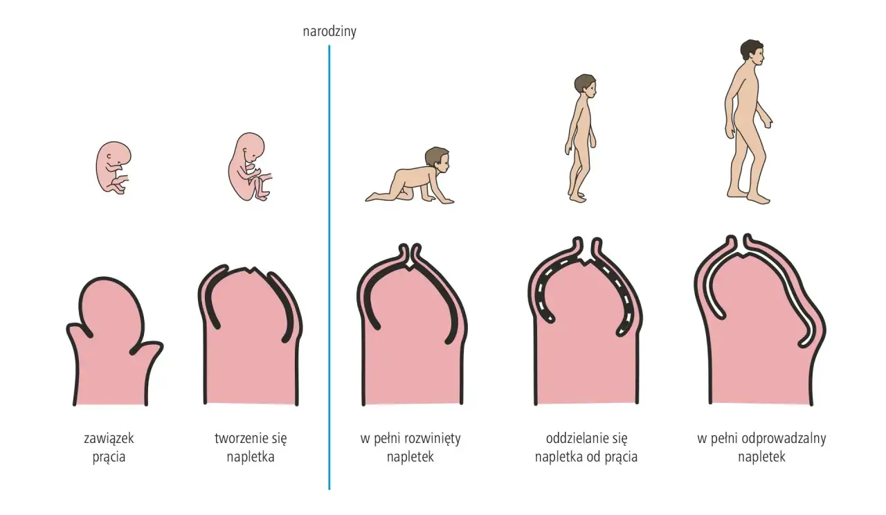 Rozwój prącia i napletka u dziecka. Ilustracja pokazuje, jak nadmiar napletka może prowadzić do stulejki i załupka u dziecka, a także jego prawidłowy rozwój.