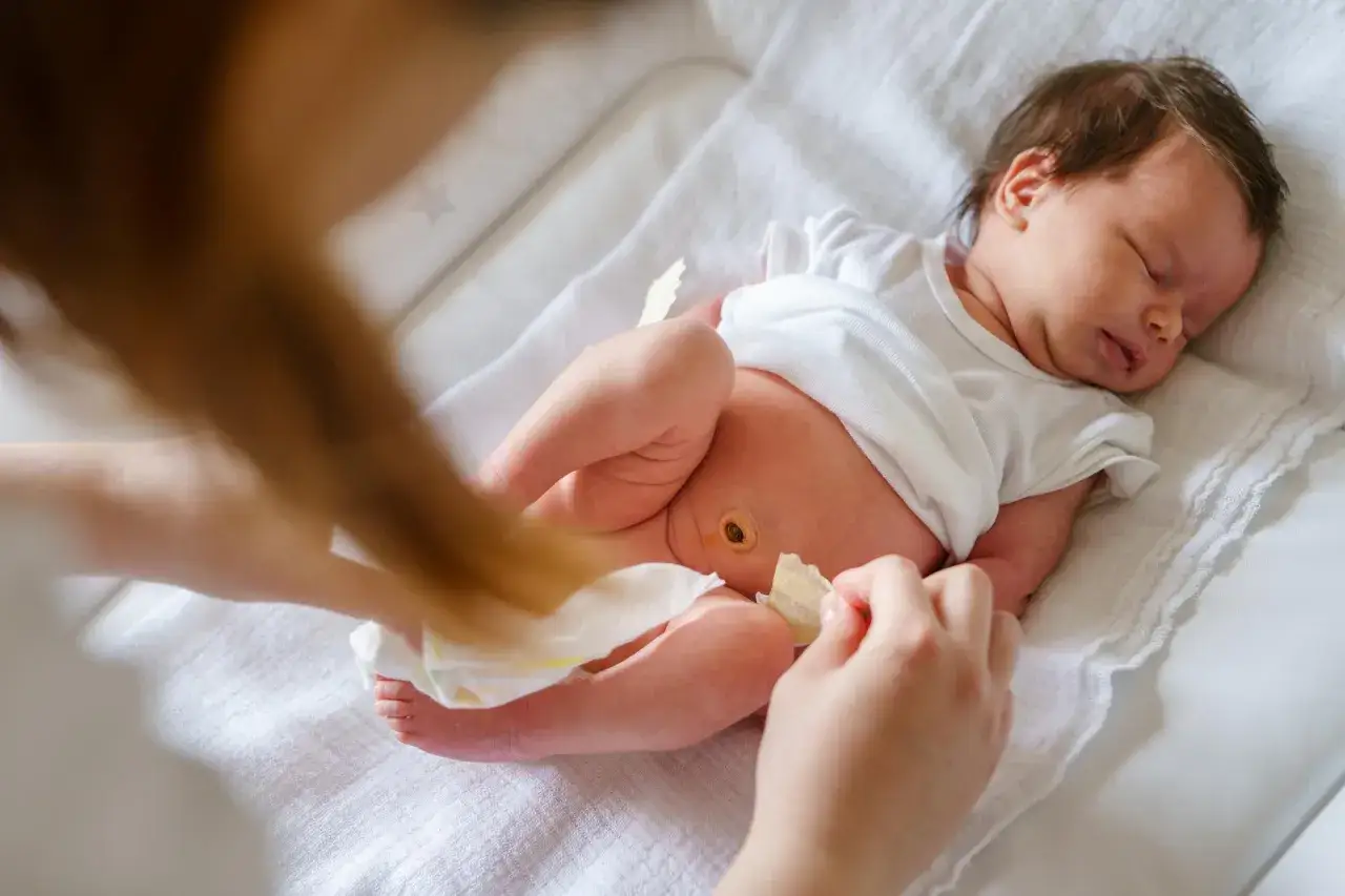 Delikatna pielęgnacja noworodka. Widoczny siny pępek u niemowlaka, który jest w trakcie gojenia.