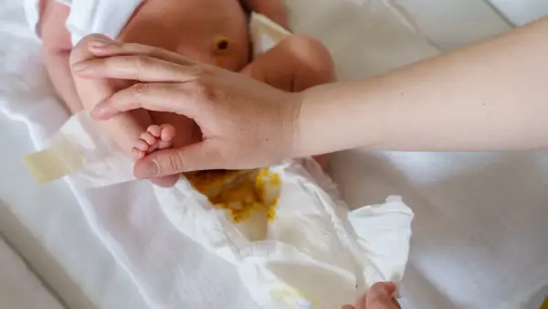 Rączka rodzica delikatnie dotyka stópki niemowlaka, podczas gdy pieluszka pokazuje zawartość – kupa niemowlaka.